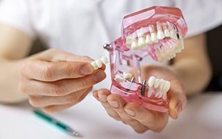 Dentist holding an implant bridge and mouth mold