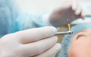 Dental implant surgery