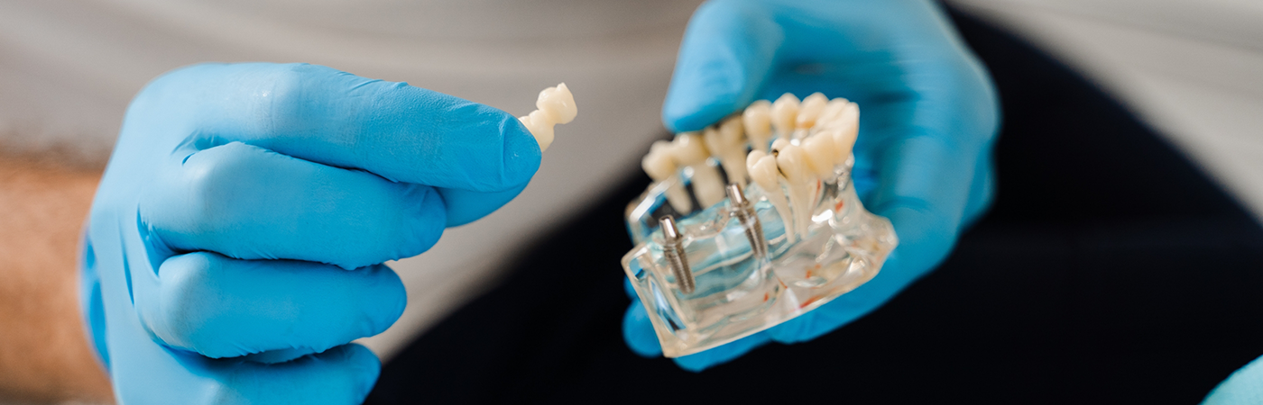 Close-up of gloved hand holding a dental bridge