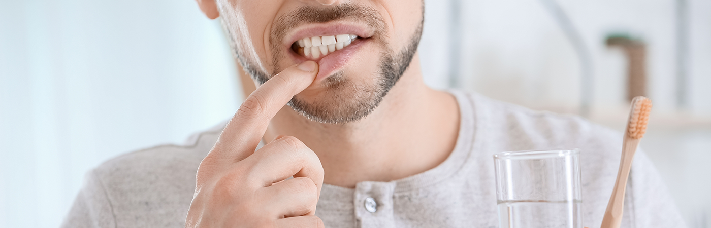 Close-up of man pulling down lip to show gums