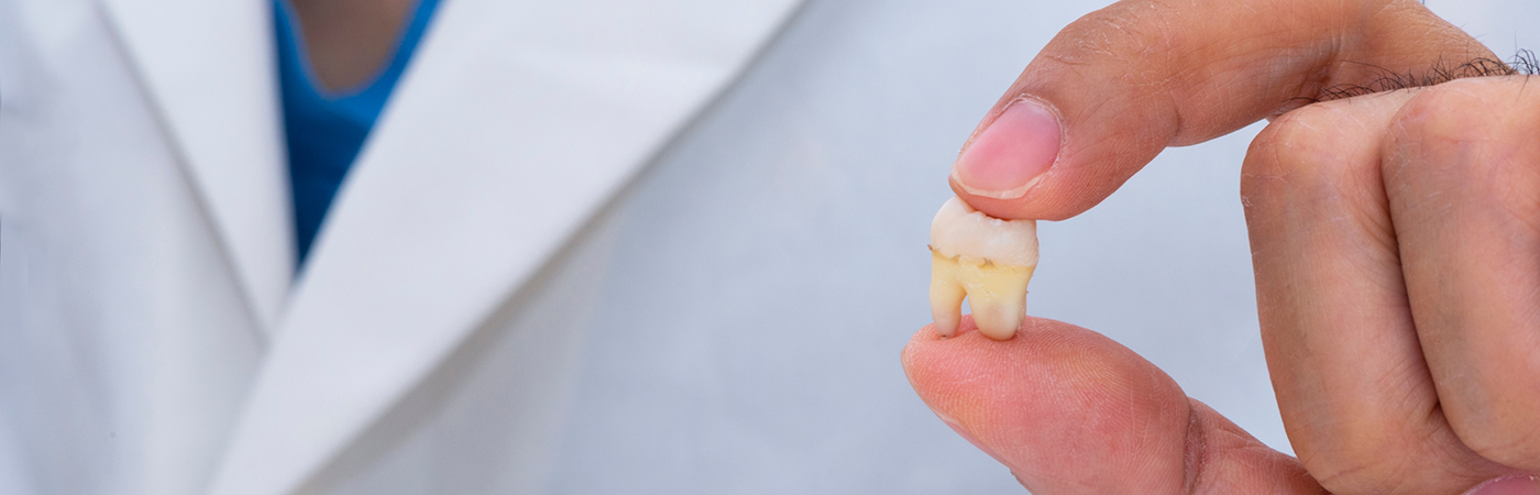 Dentist holding tooth after tooth extraction in Arlington